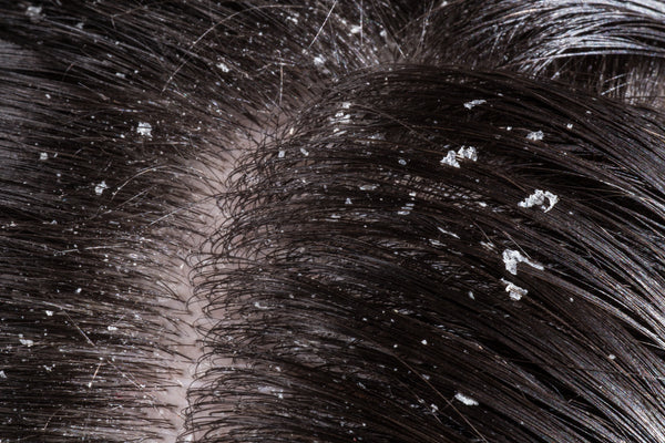 Unveiling the Power of Collagen: A Secret Weapon Against Dandruff