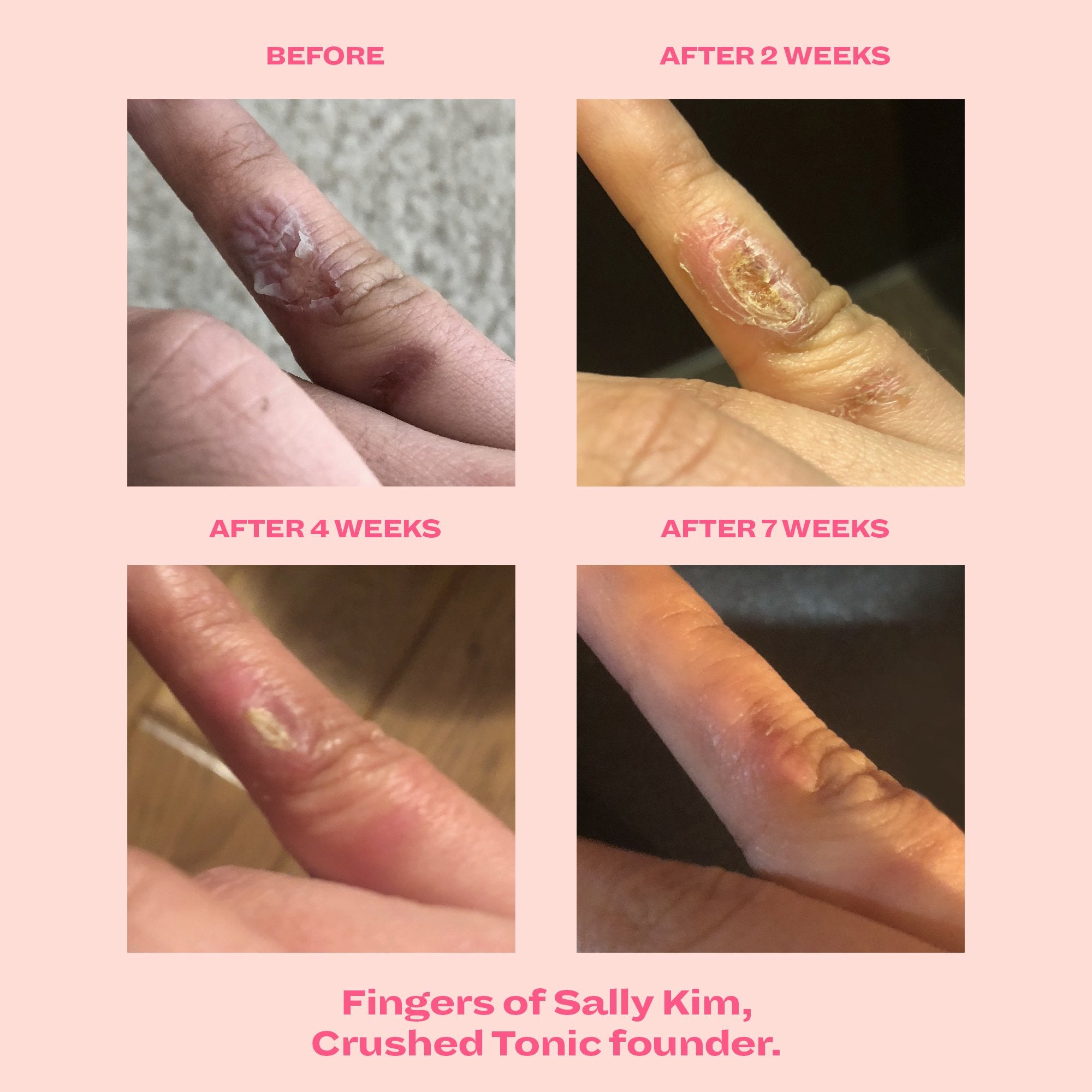 Research shows improved skin hydration, skin elasticity, and skin texture in 8 weeks!
