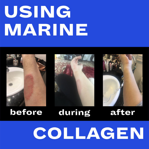 Collagen and Skin: A Love Story